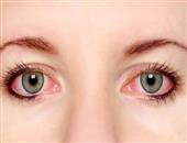 青光眼疾病的相关症状会是什么呢