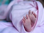 新生儿头皮血肿大小的鉴别 新生儿头皮血肿大小的产生