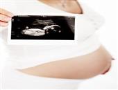 孕前检查项目是什么 孕前检查的注意事项