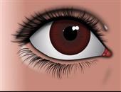 眼底出血的原因是什么 眼底出血怎么办