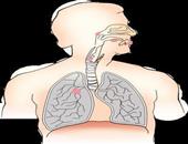 肺部肿瘤手术费用 肺部肿瘤有什么症状