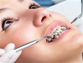 据说戴钢牙套会导致牙龈萎缩是真的吗