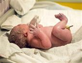 新生儿疾病有哪些 4种新生儿常见病症状