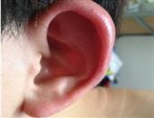 耳鸣也可能是心血管惹的祸