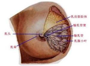 乳管内乳头状瘤