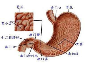 胃神经纤维瘤