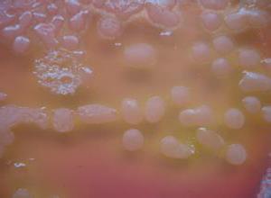 蜡样芽孢杆菌食物中毒