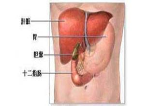 胆囊管综合征