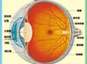 主动脉弓综合征视网膜病变