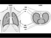 结核性干性胸膜炎
