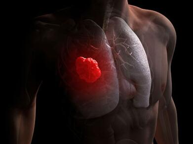 冠心病怎么食疗