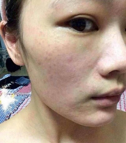 女人皮肤粗糙多吃5种食物