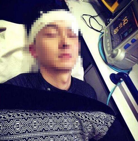 老年人预防脑中风的饮食