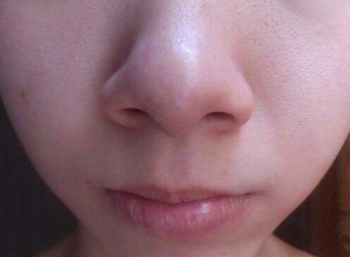 巧用食物缩小毛孔