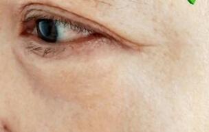 四大饮食方法 让你没有鱼尾纹