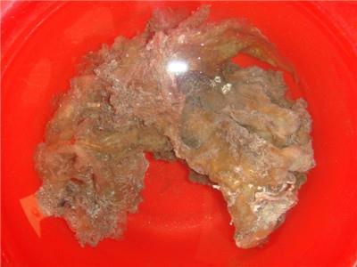 防便秘一定要注意着五个方面误区