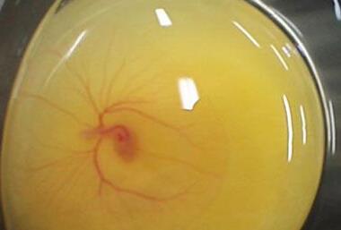 警惕：吃鸡蛋必知11个健康问题