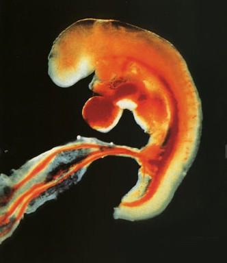 孕期接触皮革可致胎儿畸形