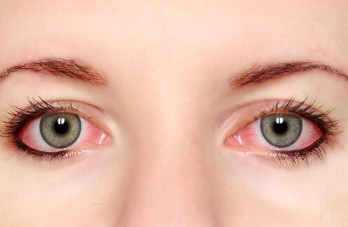 青光眼疾病的症状主要是什么呢
