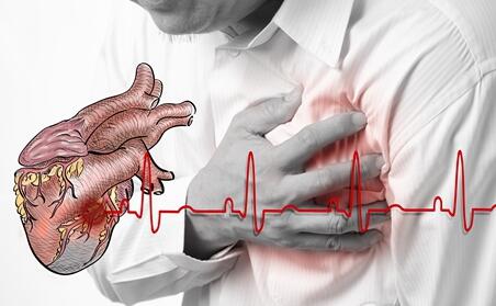 心脏早搏应该怎么锻炼 怎么治疗心脏早搏