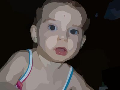 婴儿肋骨两边不一样高 婴儿肋骨两边不一样高怎么回事