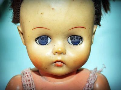 瓷娃娃单基因遗传病主要有哪些改变 瓷娃娃的临床表现有哪些