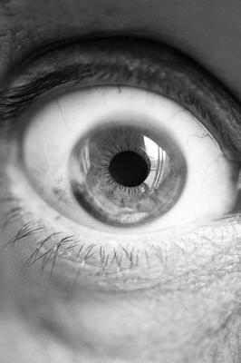 白眼球有血丝发黄的原因 如何保护眼睛