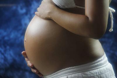 孕纹妊娠纹怎么消除 如何预防妊娠纹