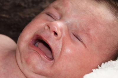 新生儿黄疸发烧不吃奶是怎么了 新生儿黄疸有什么症状
