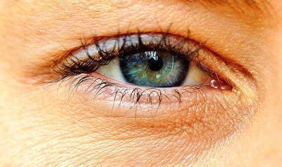 眼底出血能激光治疗吗 眼底出血的4个常见病因
