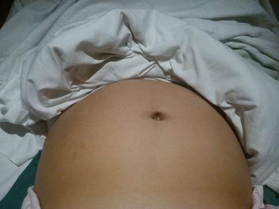 8个月长妊娠纹怎么办 出现妊娠纹的原因是什么