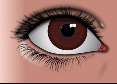 怎么治疗视膜病变的症状 如何预防视网膜病变