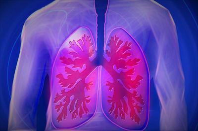 慢性肺炎病因 肺部疾病的诱发因素