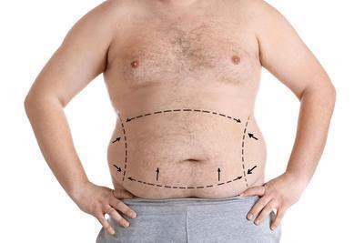 减肥后肥胖纹怎么去除？肥胖纹是怎么形成？
