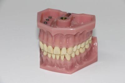 牙周病的中医治疗方法 牙周病会引发哪些疾病