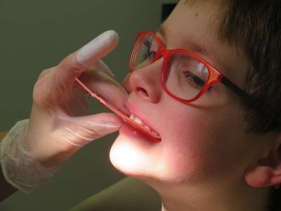 小孩睡觉磨牙是什么原因 宝宝磨牙的预防