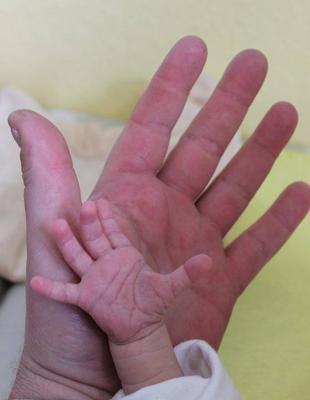 宝宝脸上被指甲划伤了怎么办 家长什么时候给宝宝修剪指甲最合适