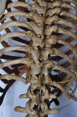 脊柱关节炎挂什么号 脊柱关节炎应该如何鉴别