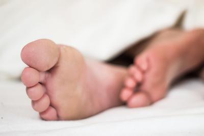 脚趾滑囊炎的恢复周期 滑囊炎如何治疗