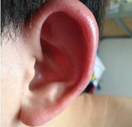 怎样利用饮食预防耳鸣的发生