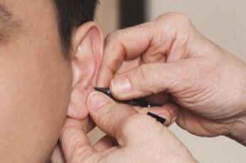 临床上耳鸣有哪几种常见类型