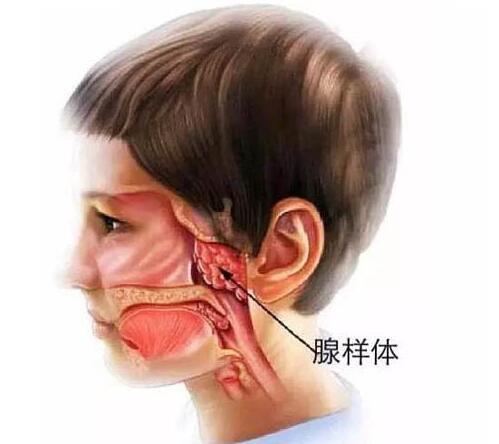 如何治疗腺样体肥大？治腺样体偏方