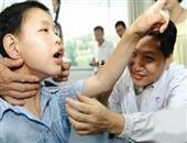 孩子作息不规律可能导致癫痫病