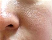 薏米DIY告别粗大毛孔和黯沉肤色