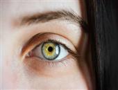 眼底出血能激光治疗吗 眼底出血的4个常见病因
