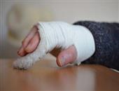 右手食指关节肿胀 关节肿胀的原因有哪些