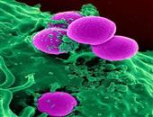 恶性纤维组织细胞瘤的类型 恶性纤维组织细胞瘤如何治疗