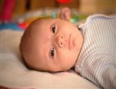 宝宝病理性黄疸有什么症状 如何预防宝宝病理性黄疸的问题