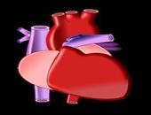 心包囊肿危险吗 心包囊肿会有什么样的症状