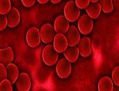 遗传性血红蛋白病的遗传几率大吗 遗传性血红蛋白病包括什么